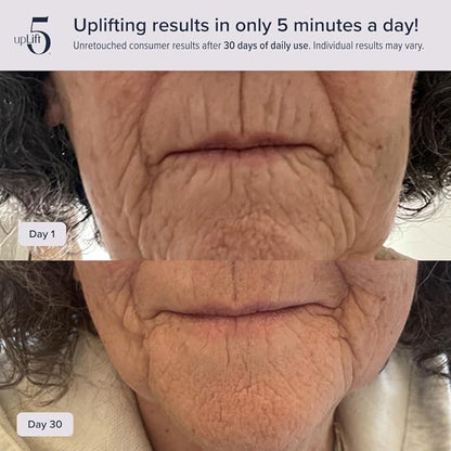 upLift 5 Pulsating Facial Lift | 5 Minute Age Reversal Device, Contours &